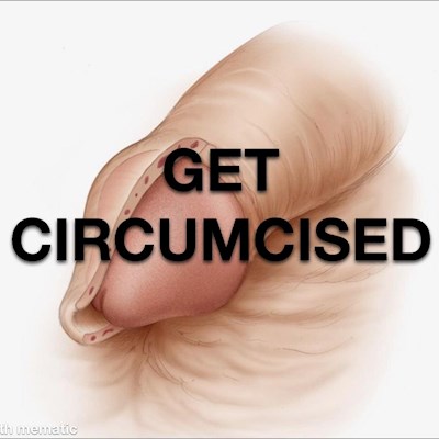 Foreskin On My Uncut Penis Do Any Of Men S Health Foru