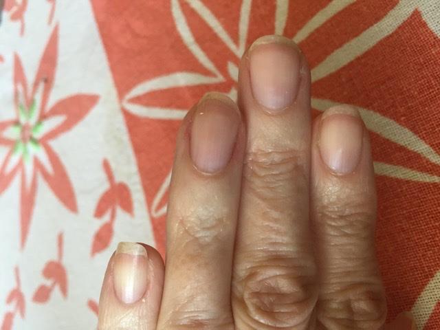 Having white or pale nails could be symptom of heart failure or liver  disease - Mirror Online