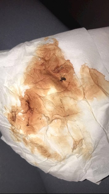 TMI PIC Implantation Bleeding Pregnancy And Par 