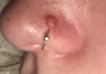 Bump near nose ring: can anyone tell me 
