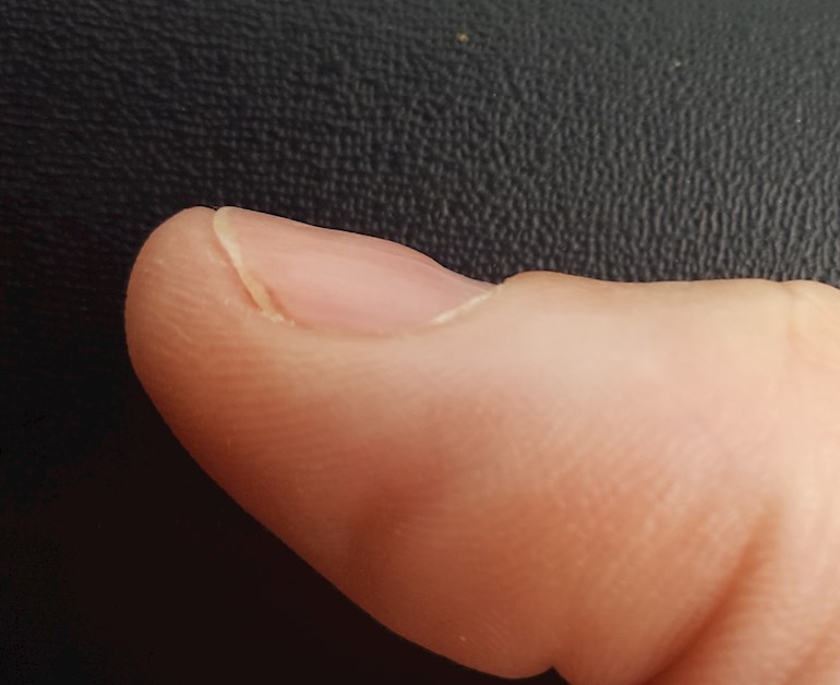 thumb nail