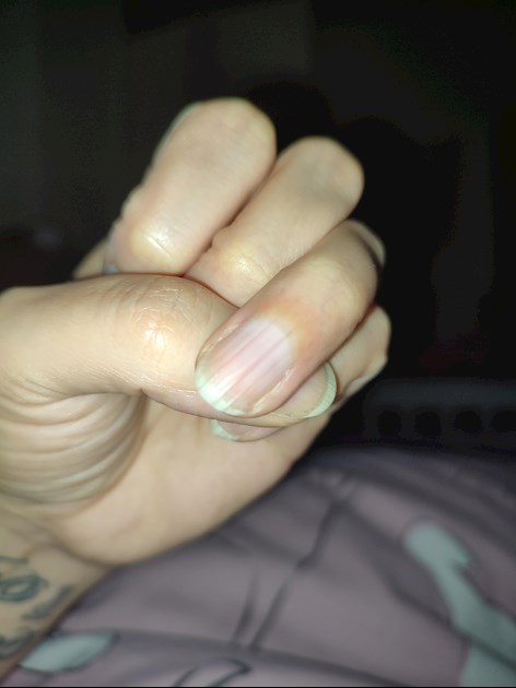 7-nail-problems-you-should-look-out-for