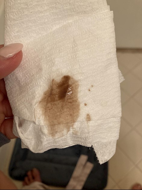 Brown blood when I wipe