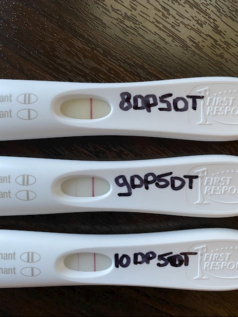 11dp5dt -pink and brown spotting - Fertility Network UK