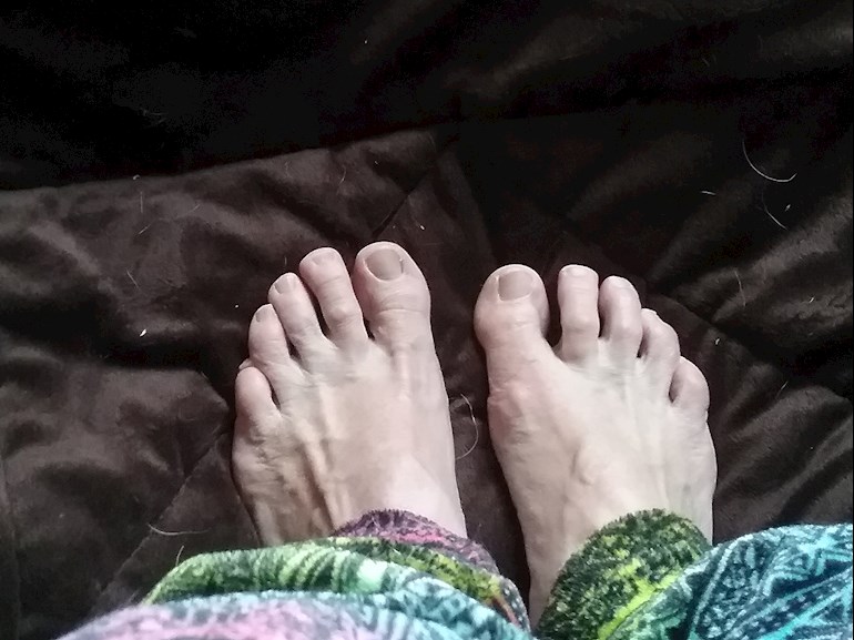Toes up do why curl 5 Causes