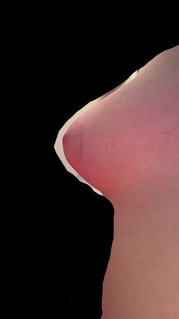 Do I have normal boobs: Picture below (side - Women's Health
