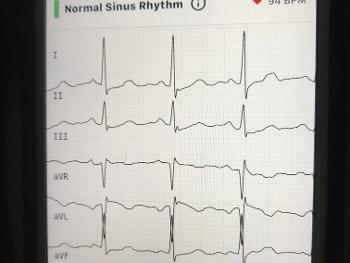 High quality QRS train of my wife 