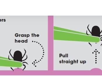How to remove a tick