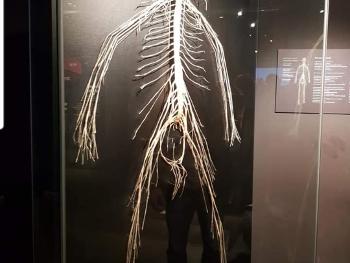 Museum piece of the nervous system.