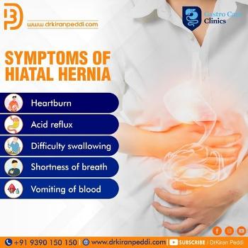 Symptoms of Hiatal Hernia by Dr. Kiran Peddi