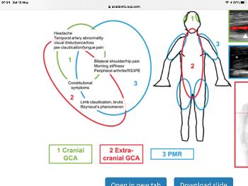 GCA/LVV/PMR