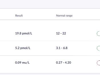 My Thyroid test results