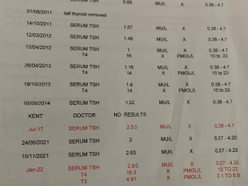 TSH results over the years
