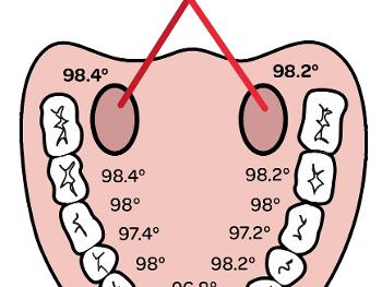 Diagram of mouth showing how temperature varies by precise location.