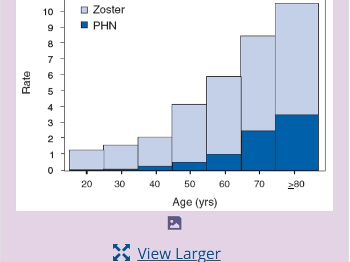 How the risk of shingles and even worse, post herpetic neuralgia, increases with age - CDC