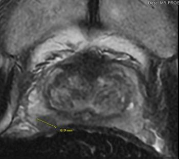 MRI Screenshot