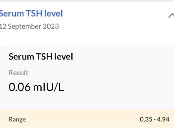 TSH Level 