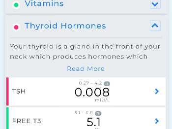 Thyroid labs 