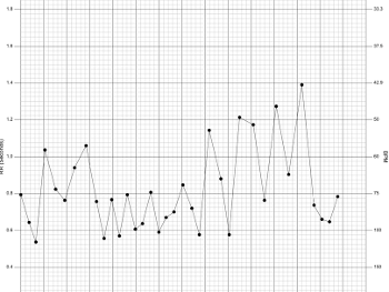 Kardia R-R interval plot