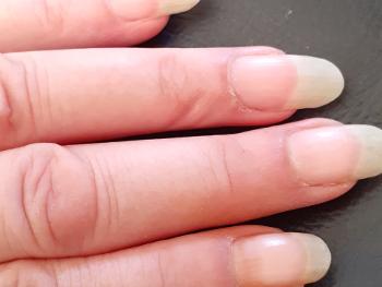 Colour photo of hand and long nails.