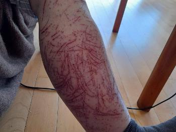 Legs, scratches 