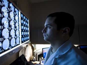 A doctor studying brain MRI images.