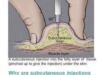 Picture of subcutaneous injection into fatty tissue under the skin.