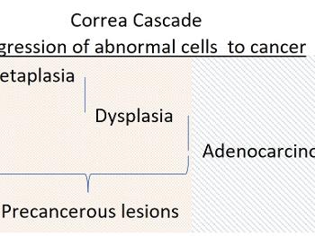 Progression of GIM to Adenocarcinoma