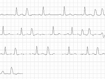 Contec ECG
