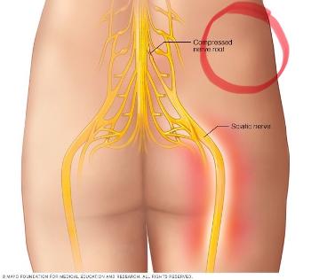 Injection location