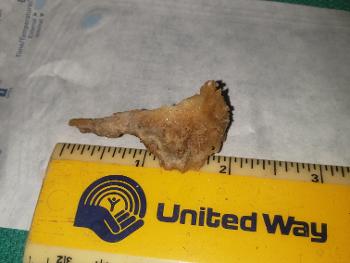 Dead bone of lower left inside jaw. Under this sheaded bone was perfect new tissue. 