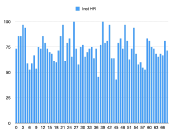 Beat to beat heart rate in AF showing the irregularly irregular pattern over one minute.