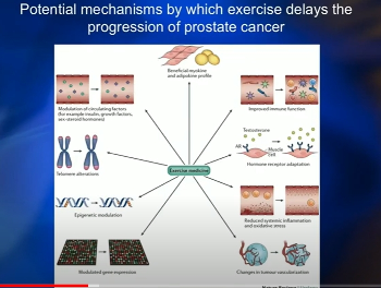 Value of Exercise while on ADT Treatment; if it were a Pill your Dr would force its use.