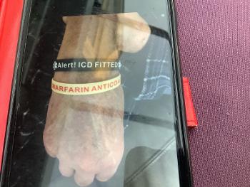Medical alert bands on wearer’s wrist