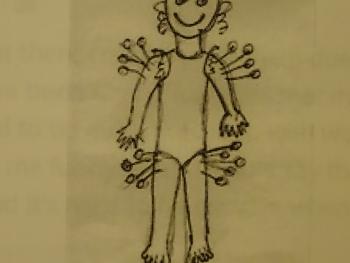 cartoon of smiling woman with about 20 needles in shoulders and thighs -by Beginner1