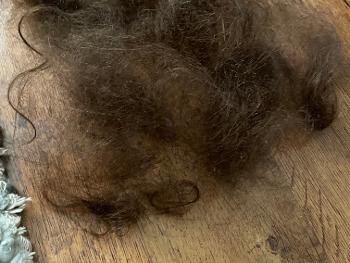 Photo of big pile of hair lost possibly due to vitamin D3 deficiency of 18 in test result