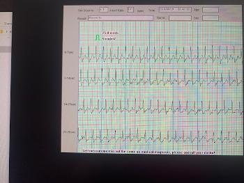 Old ECG