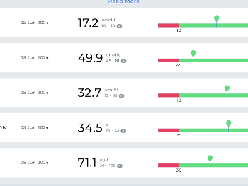 Iron results