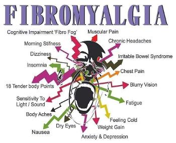 Colour representation of fibromyalgia sufferers pain.