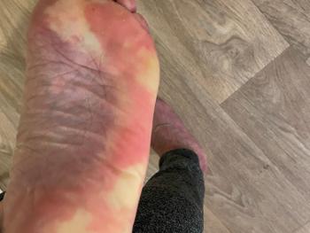 Bottom of foot 