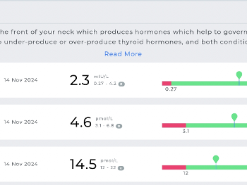 Thyroid panel results