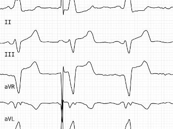 Screenshot of ecg 