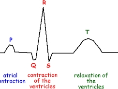 Diagram of PQRST 