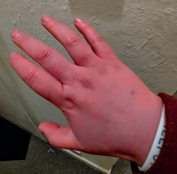 My hands these last few weeks 
