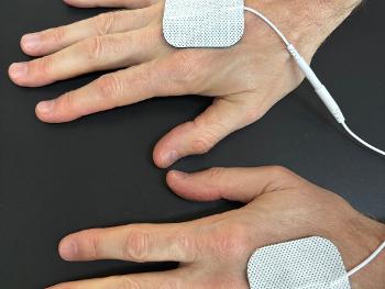 Picture of my hands using the TENS device.  
