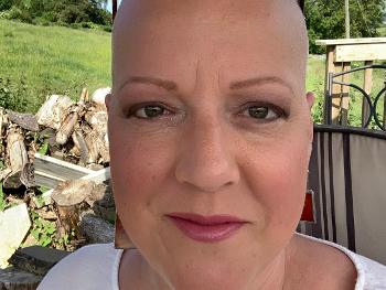 Chemo haircut, no lashes, and painted on brows!