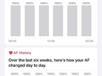 Afib report from my Apple iPhone