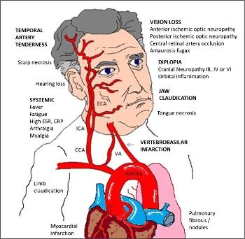 Head arteries