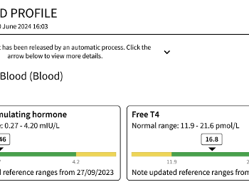 thyroid tests