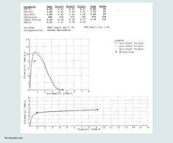 Normal flow curve graph for spirometry